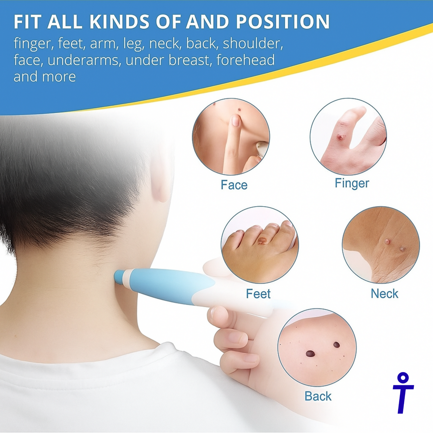 EraseTags™ | No More Skin Tags